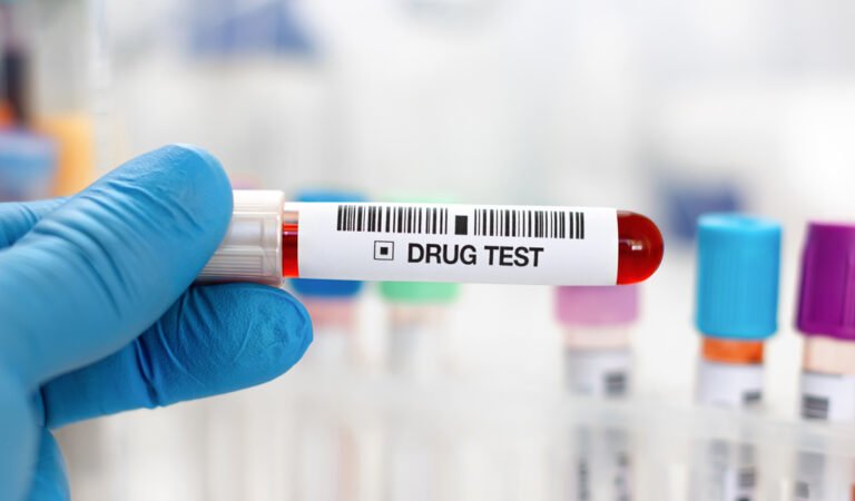 Pre-Employment Drug Testing vs. Ongoing Employee Drug Testing
