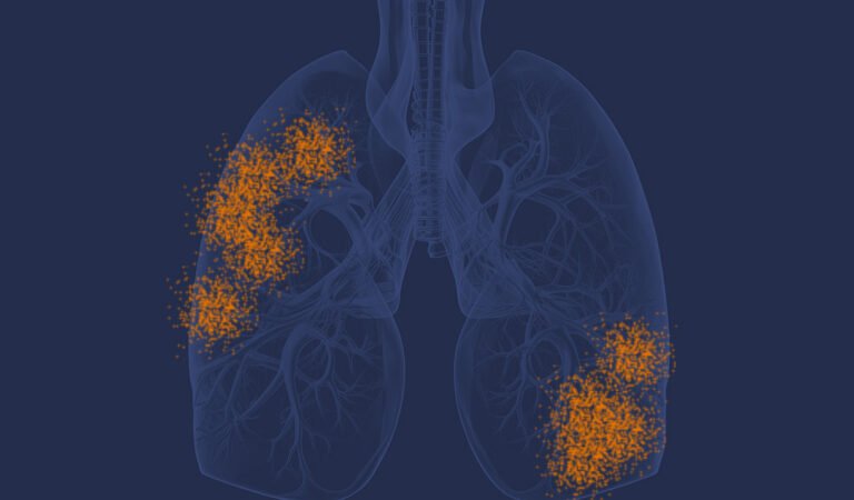 Understanding Mesothelioma Claims, Deadlines, and Compensation for Indiana Asbestos Victims